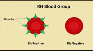 Rh group